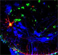 Confocal image from mouse spinal cord